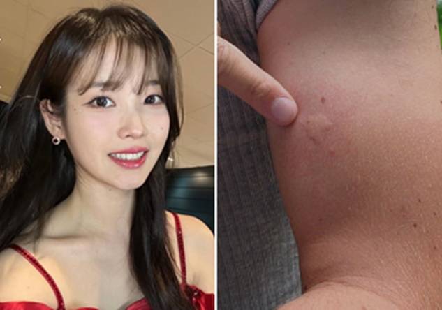 가수 아이유. 오른쪽은 기사와 상관없는 참고 사진. 아이유 인스타그램, 픽사베이