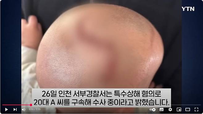 10개월 3.JPG 시내버스에서 생후 10개월된 아기에게 핸드폰 던져 중상 입힌 20대 여성