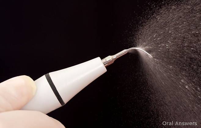 2.jpg 치과 스케일링에 대한 오해류 甲