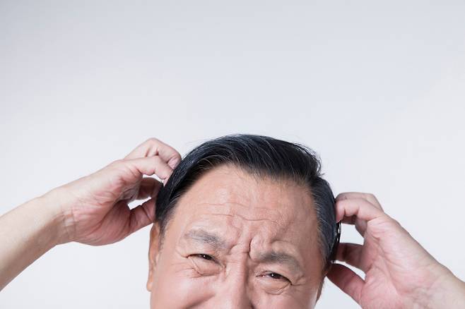 중년 남성에게 자주 발생하는 지루성 피부염이 주목된다. 사진은 기사 내용과는 무관함. /사진=이미지투데이