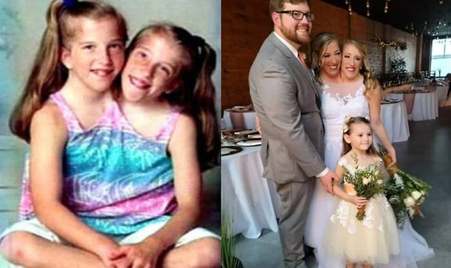 유명한 샴쌍둥이가 임신을 했다는 추측이 돌며 화제가 되고 있다. *오른쪽 사진 속 아이는 결혼식 때 화동. 샴쌍둥이의자녀가 아님 [사진='데일리메일' 보도내용 캡처]