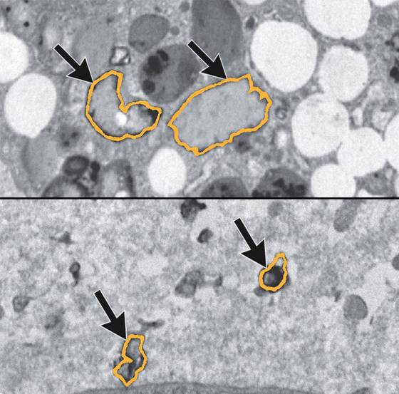 국내 연구진이 사람의 콧속 점막 조직에서 미세플라스틱을 확인했다. 미세플라스틱 조각이 자연 환경을 오염시킬뿐 아니라, 사람의 몸에도 축적될 수 있다는 연구가 속속 나오고 있다. 사진은 사람의 신체 조직에서 발견된 미세플라스틱 조각의 모습. 중앙포토