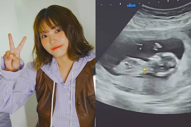 ▲ 이진아. 출처| 이진아 SNS