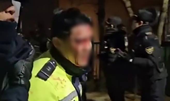 19일 서울서부지법 난입 사태에 부상당한 경찰관. 엑스 갈무리