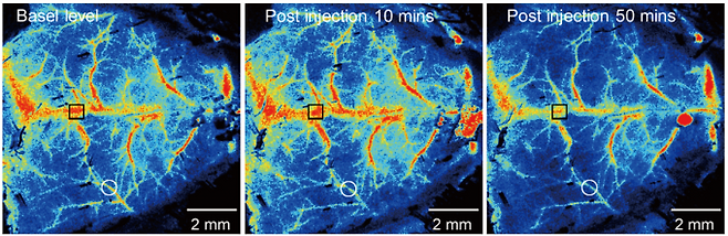 미세플라스틱이 쥐의 뇌를 통과하는 과정을 추적한 뇌혈관 현미경 이미지. 혈류량이 많으면 빨간색으로 표시된다. 미세플라스틱 침투 전(왼쪽)보다 혈액 흐름이 감소하는 것을 확인할 수 있다. Huang et al.(2025)/Science Advances 제공