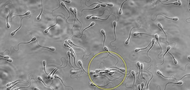 전자현미경으로 촬영한 황소 정자. 일부 정자들은 무리지어 움직이고 있다(노란 원).최근 정자가 난자에 도달하기 위해 무리지어 움직인다는 연구가 발표되는 등 기존 통념과는 다른 정자의 행동들이 밝혀지고 있다. Frontiers in Cell and Developmental Biology 제공