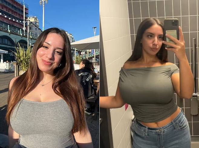 20대 영국 여성이 J컵 가슴을 줄이기 위해 수술을 요청했지만 병원에서 거부당한 사연이 공개됐다. 9살 때부터 가슴이 빠르게 성장했다는 이 여성은 허리 통증을 비롯 심리적 고통을 꾸준히 겪었다. [사진=영국 매체 데일리메일 보도 갈무리]