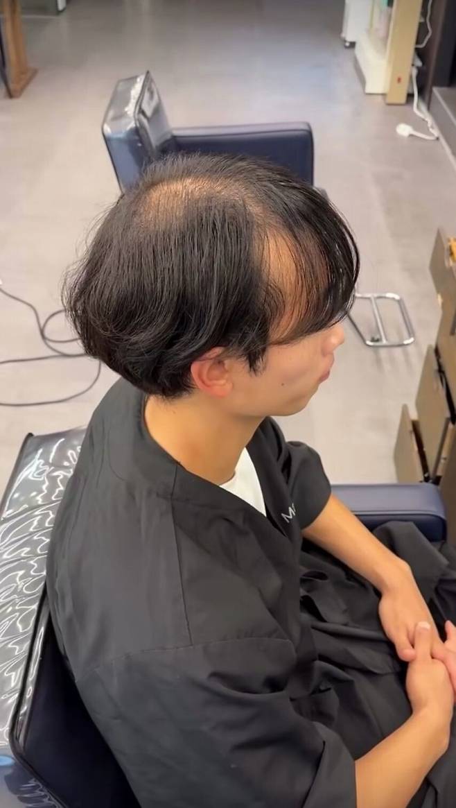 놀라운 탈모 커버업ㄷㄷㄷㄷㄷ