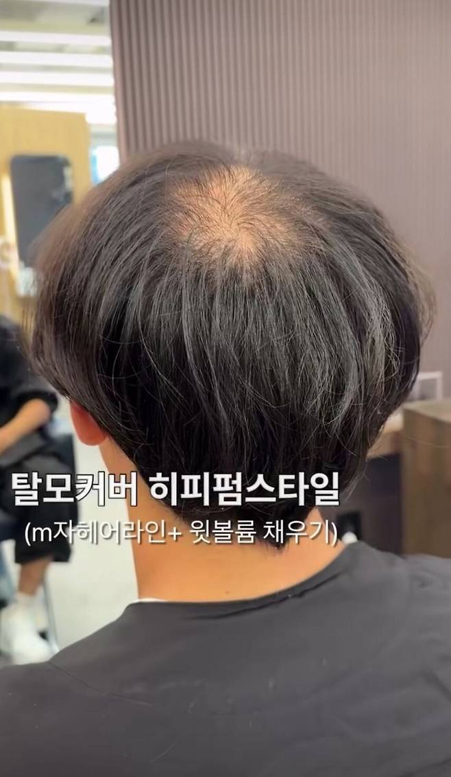 놀라운 탈모 커버업ㄷㄷㄷㄷㄷ