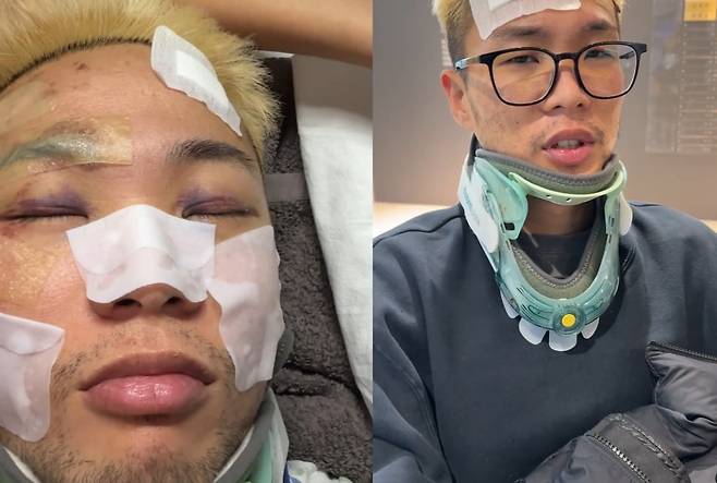 사진=우디고차일드 SNS