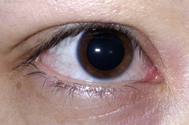 망막박리, 황반변성, 당뇨망막병증 등 실명까지 유발할 수 있는 눈 질환들이 있다./사진=클립아트코리아