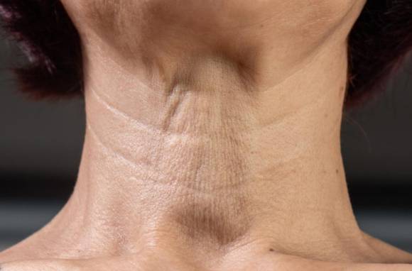 바세린을 목에 바르면 목주름을 없애는 데 효과가 있다는 전문의의 분석이 나왔다. 사진은 본 기사 내용과 무관함. [사진=House of Beauty Camberley]