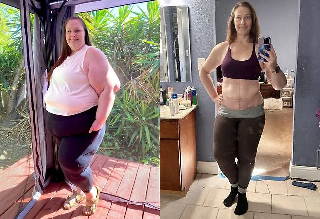 토리 필립스(39)는 위소매절제술과 식단 관리를 통해 90kg을 감량했다./사진=뉴욕 포스트