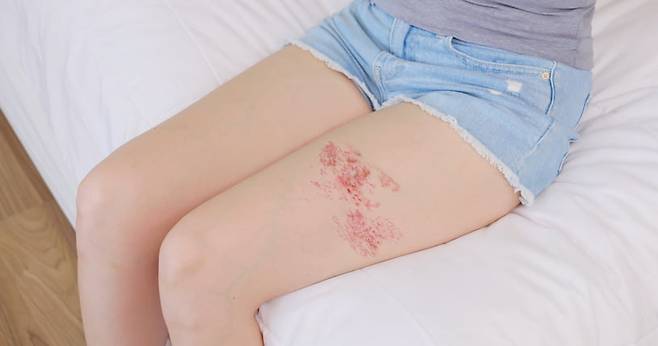 사진은 기사와 관련 없음 /게티이미지뱅크