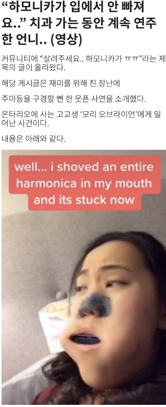 윌레스.jpeg 실제로 하모니카가 입에 들어간 사례.jpg