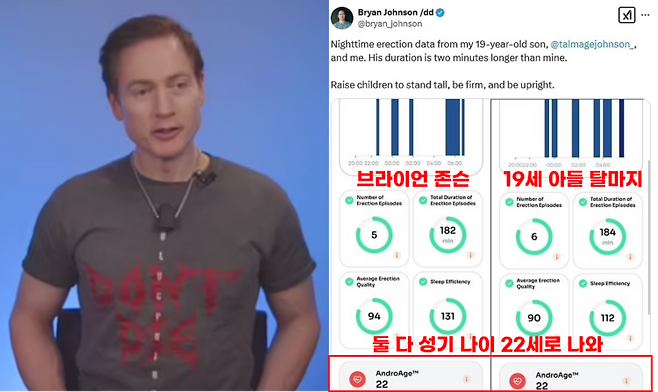 브라이언 존슨은 최근 자신의 아들 탈마지(Talmage)와 야간 발기 데이터를 비교한 트윗을 올려 논란을 일으켰다. 공개된 데이터에 따르면 탈마지는 존슨보다 2분 더 긴 발기 시간을 기록했지만, 두 사람 모두 22세 수준의 AndroAge 점수를 받았다.[사진=영국 일간 데일리메일/ 브라이언존슨 X(옛 트위터) 캡처 ]