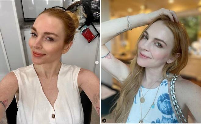 성형외과 전문의뿐 아니라 여러 분야의 의사들이 지적하는 점은 '린지가 이전에 주입했던 필러를 녹였을 가능성이 크다'는 점입니다.  [사진=린지 로핸 인스타그램]