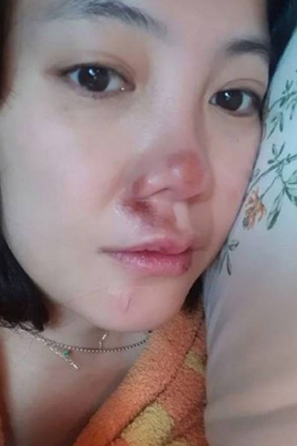 고은아