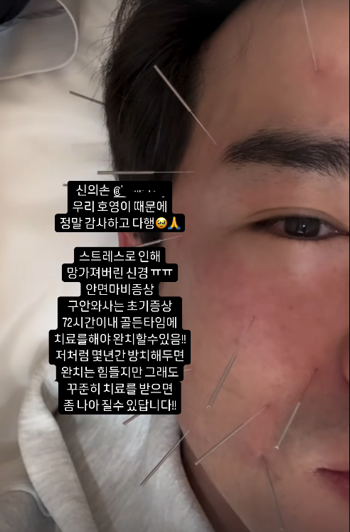 '가스라이팅 피해자' 신화 이민우, 안면신경마비 호소... “스트레스로 망가져”(출처: 이민우 인스타그램 갈무리)