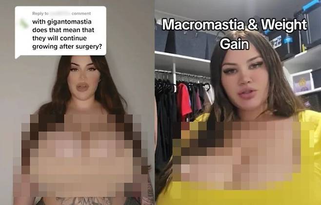 살을 뺐음에도 불구하고 가슴 크기는 줄어들지 않는다는 여성의 사연이 전해졌다. 사진=영국 일간 더선 보도 캡처