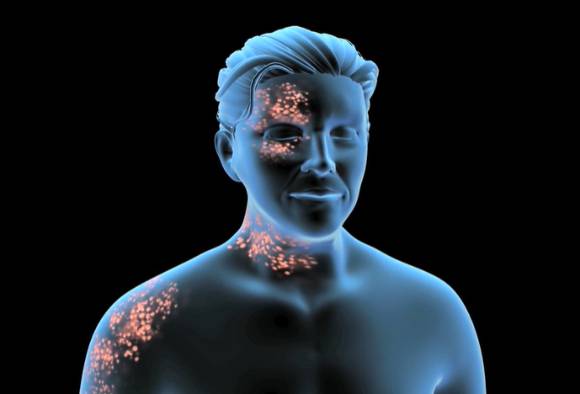 대상포진은 극심한 통증을 유발하는 질환으로, 주로 면역력이 약해지는 환절기에 발생하며, 발병 원인과 적절한 대처법을 모르면 골든타임을 놓쳐 증상이 더 악화할 가능성이 있다. 사진은 본 기사 내용과 무관함. [사진=Nucleus Medical Media]