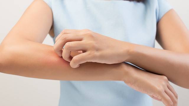 피부를 긁은 자국이 그대로 부풀어 오른다면 피부묘기증 때문일 수 있다｜출처: 게티이미지뱅크