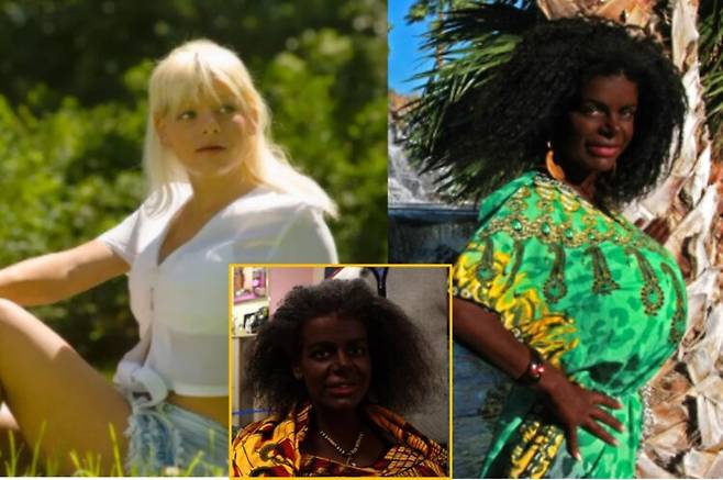 백인으로 태어나 백인의 삶을 살아 온 여성이 멜라닌 주사를 맞아 피부색을 어둡게 바꾸고 자신을 '흑인'이라고 주장하며 아프리카 이주를 계획하고 있다고 밝혀 논란이 일고 있다. [사진=영국 일간 미러 보도 갈무리]