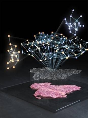A computer-generated image illustrating a network graph of a cancer tissue [SEOUL NATIONAL UNIVERSITY]