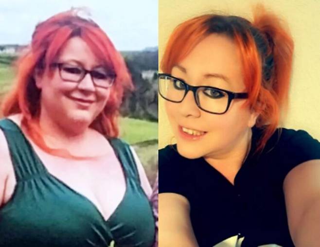 치통을 호소했지만 치과 진료를 받지 못해 전전긍긍하다 응급실 간 30대 여성이 CT 촬영 중 사용된 조영제에 치명적인 알레르기 반응을 일으켜 숨지는 사건이 발생했다. [사진=영국 일간 미러 보도 갈무리]