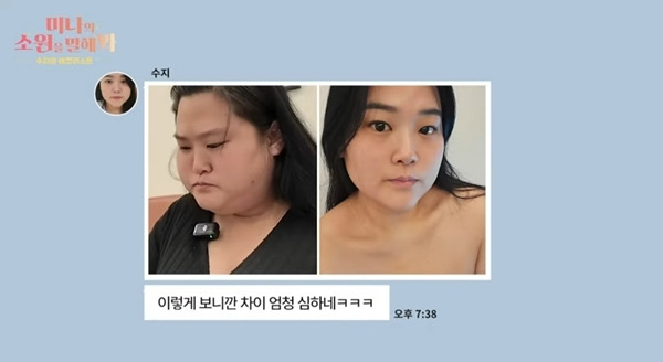 가수 류필립의 누나이자 미나의 시누이 박수지가 극한의 감량 후 피부 탄력을 되찾기 위해 리프팅 시술을 받았다. 사진=유튜브 캡처