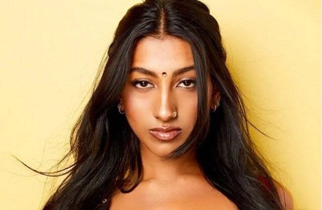 캣츠아이 라라(사진=SNS)