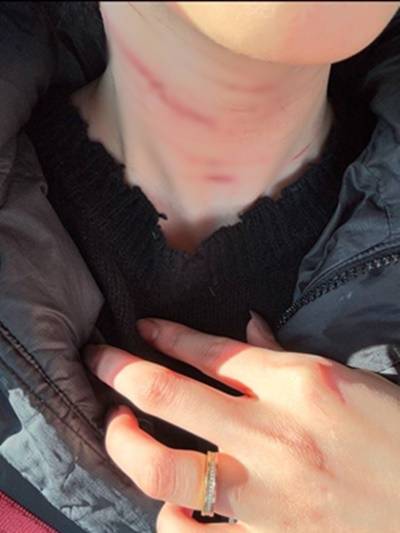 김새론은 사망 직전까지 두 남자 사이에서 고통스런 나날을 보냈다. 김새론은 정신적인 혼돈을 거듭하며 수차례 자해를 시도했다. /제보사진 더팩트 단독입수