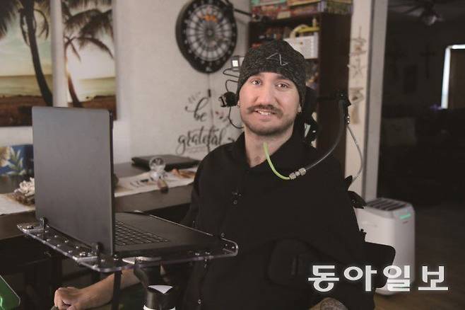 일론 머스크가 설립한 뇌신경과학 스타트업 뉴럴링크의 컴퓨터 칩을 뇌에 이식받은 놀런드 아보 씨. 동아일보DB