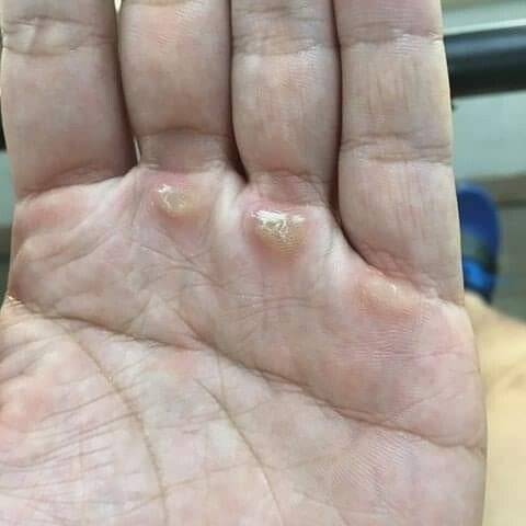 헬스하면 의외로 가장 빨리 변하는 부위.