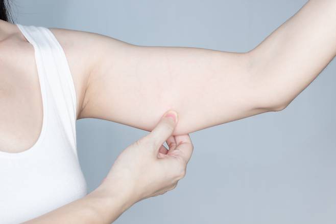도대체 팔뚝 살은 왜 이렇게 잘 빠지지 않을까? 무엇보다 자신의 운동 방법이 맞는지 체크해봐야 한다. [사진=게티이미지뱅크]