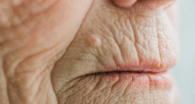 뇌의 인지력에 영향을 주는 것으로 보이는 구강 미생물군이 발견됐다. 엑서터대 제공