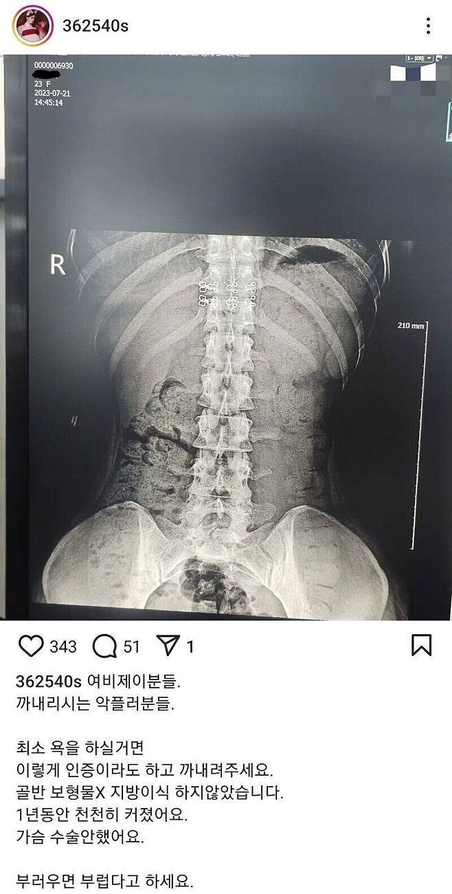 IMG_6534.jpeg 빡쳐서 자연산 골반 인증하는 BJ