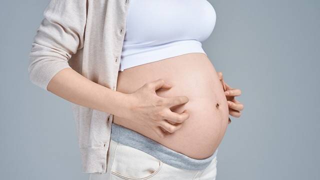 임신 중에는 피부 가려움증이 쉽게 나타난다|출처: 게티이미지뱅크