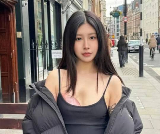 희귀질환으로 한쪽 가슴이 제대로 발달하지 못한 중국의 한 20대 여성이 보석으로 만든 인공 가슴으로 자신감을 되찾아 화제다.<홍콩 사우스차이나모닝포스트 보도 캡처>