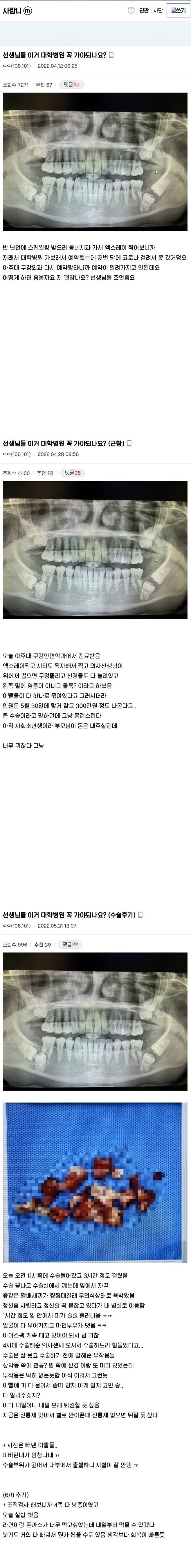 IMG_3874.jpeg 사랑니 수술 레전드.jpg