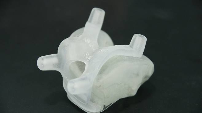 3D 프린터로 재현한 환자의 무릎관절과 인공관절 수술 도구. 연세사랑병원 제공 