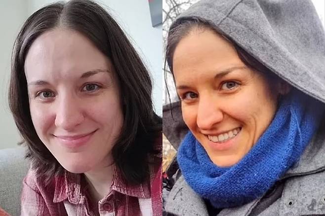 당근 과다 섭취 후 얼굴이 주황색으로 변한 여성 [레딧]