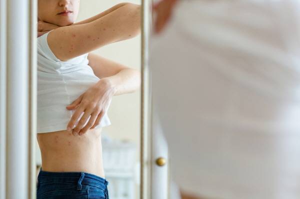 영국 보건당국이 암 조기 진단을 돕기 위해 주의해야 할 신체 변화 목록을 공개했다./사진=게티이미지뱅크