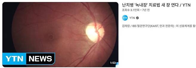 IMG_4241.jpeg 의학관련 신기술은 조금 걸러들어야되는 이유 ㅎㄷㄷㄷㄷ