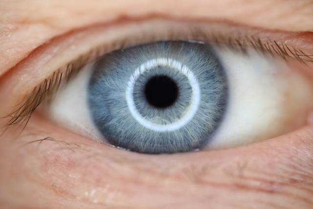 망막 안저 사진으로 ADHD를 예측하는 AI모델이 개발됐다. 사진은 기사의 특정 사실과 관련 없음. 게티이미지뱅크