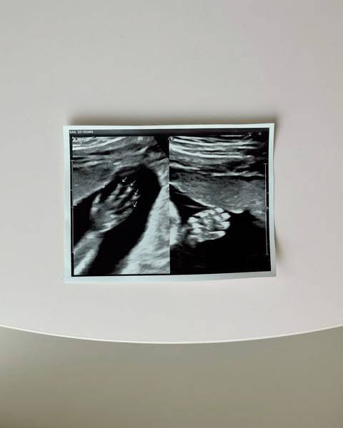 (사진=반소영 SNS)