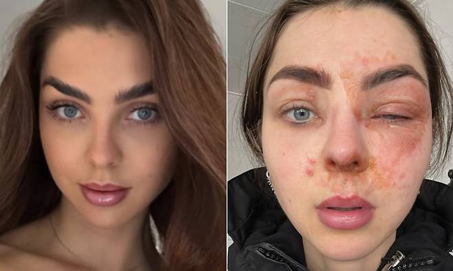 사진=kimmydutchy 인스타그램