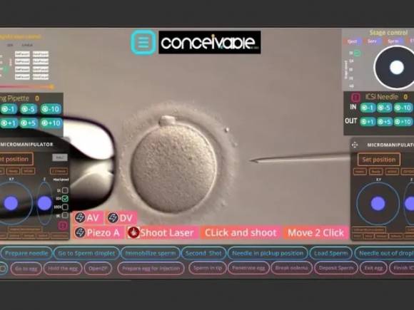 의료 전문가가 라이브 스트리밍을 통해 원격으로 시험관(IVF) 시술을 진행하고 있다. 컨시버블 라이프 사이언스(Conceivable Life Sciences) 제공