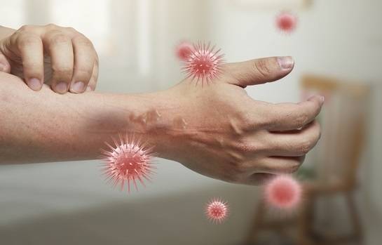 비브리오패혈증균에 감염 시 주요 증상으로는 평균 12~72시간의 잠복기를 거쳐 발열, 오한, 혈압저하, 구토, 설사 등이 나타나며 대부분 증상 발생 24시간 내로 피부에 부종, 발적, 반상 출혈, 수포, 궤양 등의 피부병변이 발생한다. 게티이미지뱅크