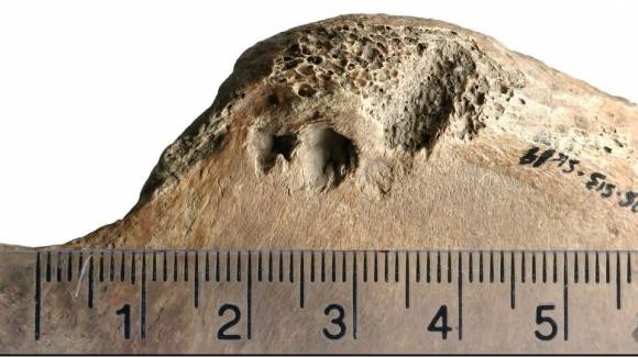 유골에 난 상처를 분석한 결과 사자에게 물렸을 가능성이 가장 높은 것으로 드러났다. PLOS One